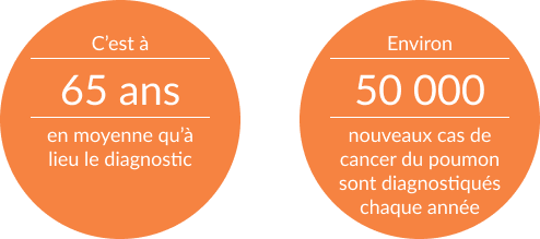Données montrant le nombre de cas de cancer du poumon diagnostiqués chaque année