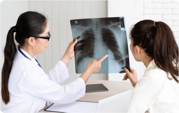 Image du diagnostic du cancer du poumon