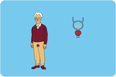 Patient atteint d'un cancer de la prostate